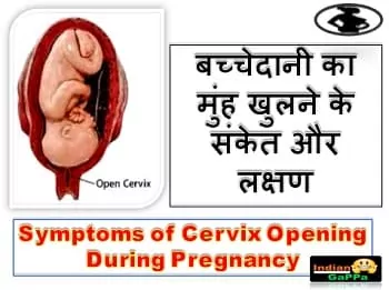 बच्चेदानी-का-मुंह-खुलने-के-संकेत-और-लक्षण,symptoms-of-cervix-opening-before-delivery